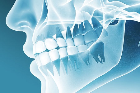 TMJ and TMD Jaw Therapy