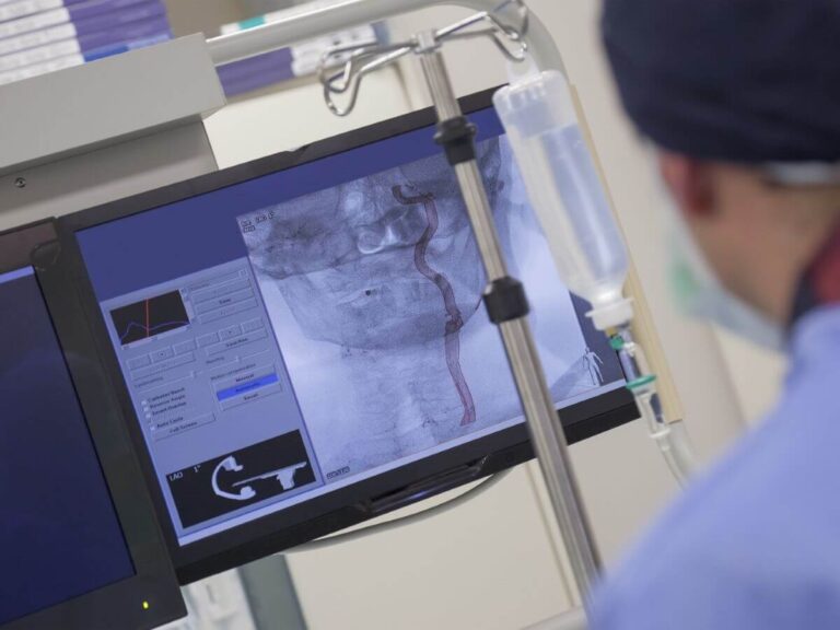 Temporomandibular Joint (TMJ) Disorder Surgery